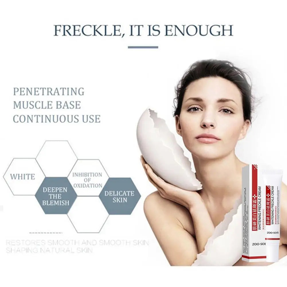 Whitening Freckle Cream Remove Dark Spots Anti Freckle Face Creams Niacinamide Fade Pigmentation Melasma Brighten Skin Care 20g