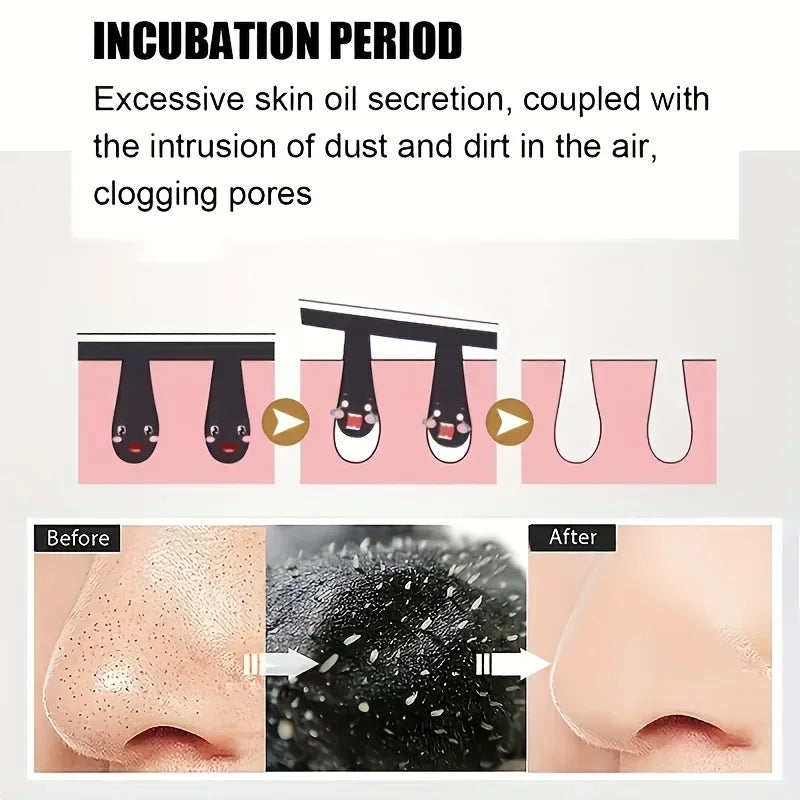 15pcs Blackhead Nose Strips Deep Cleansing Nasal Spot Facial Dot Stickers Nose Mask Shill For Acne & Black Head - Dropship